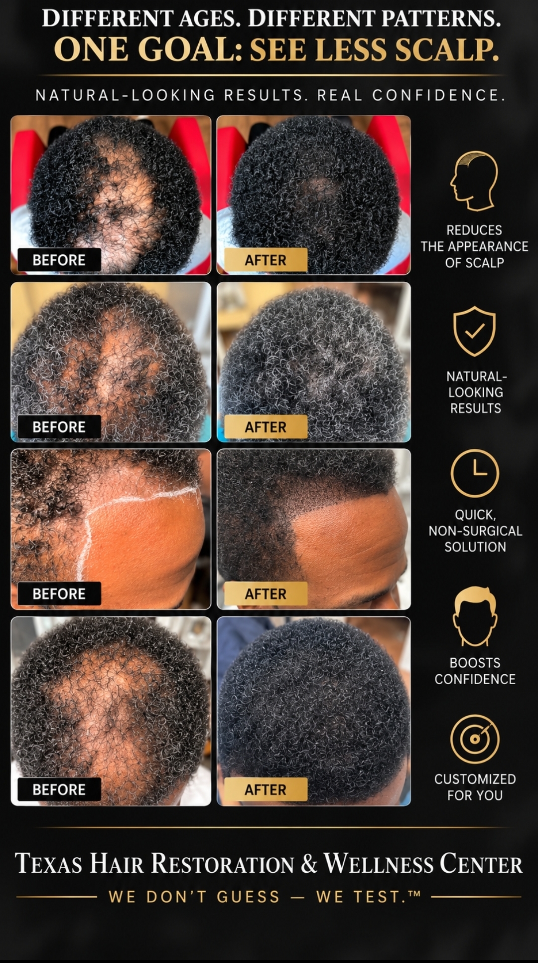 Four authentic client before-and-after examples showing fuller, denser-looking hair coverage
